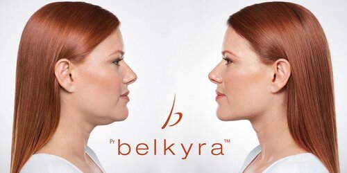 A Belkyra comparison graphic showing a profile before and after submental fat reduction