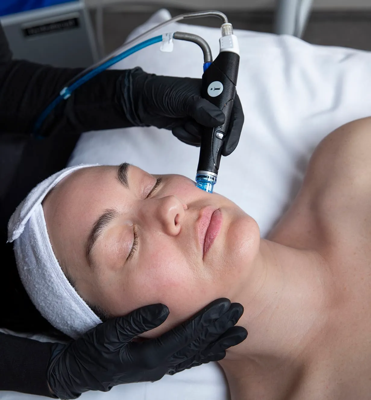A patient receiving a customized UltraFacial treatment