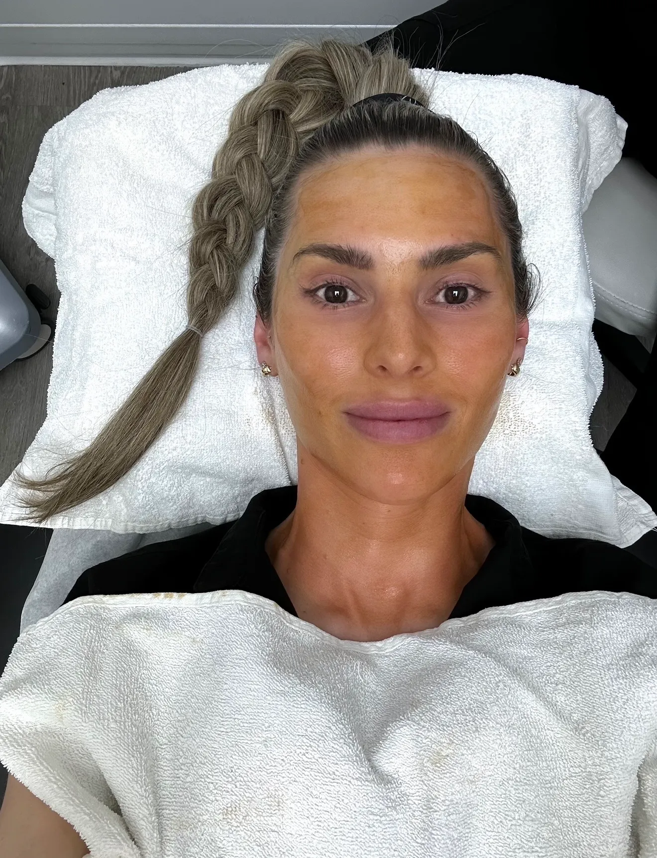A patient resting in the treatment room, skin prepped for The Perfect Derma Peel